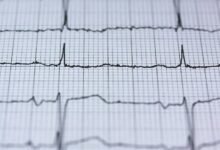 apex node neural pulse